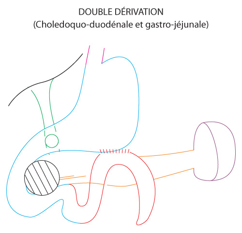 shema-double-derivation