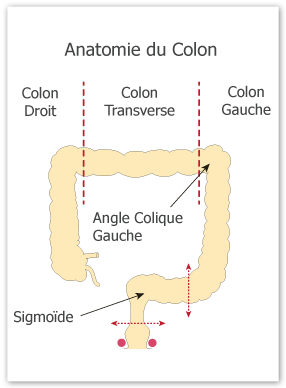 Chirurgie du Colon - Chirurgie Viscerale Saint-Etienne